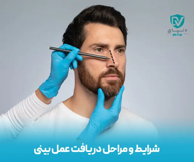 تسهیلات جراحی بینی به صورت اقساطی